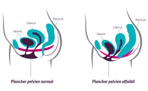 schéma plancher pelvien